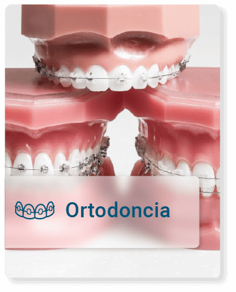 Brackets de ortodoncia para corrección de maloclusión dental