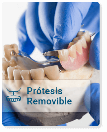Prótesis removible diseñada para pacientes con pérdida dental