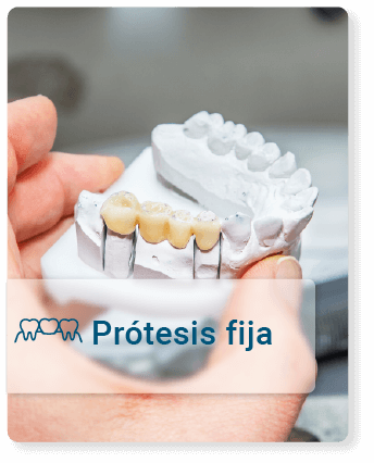 Prótesis fija para restauración dental permanente
