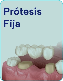 Tratamientos-con-protesis-fija