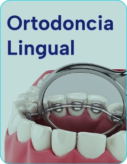 Tratamientos-de-Ortodoncia-lingual