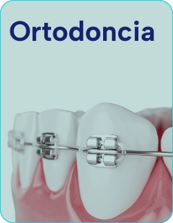 Tratamientos-de-Ortodoncia