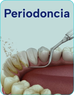 Tratamientos-de-periodoncia