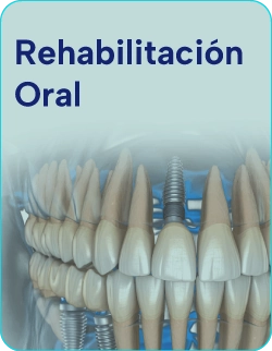 Tratamientos-de-reabilitacion-oral