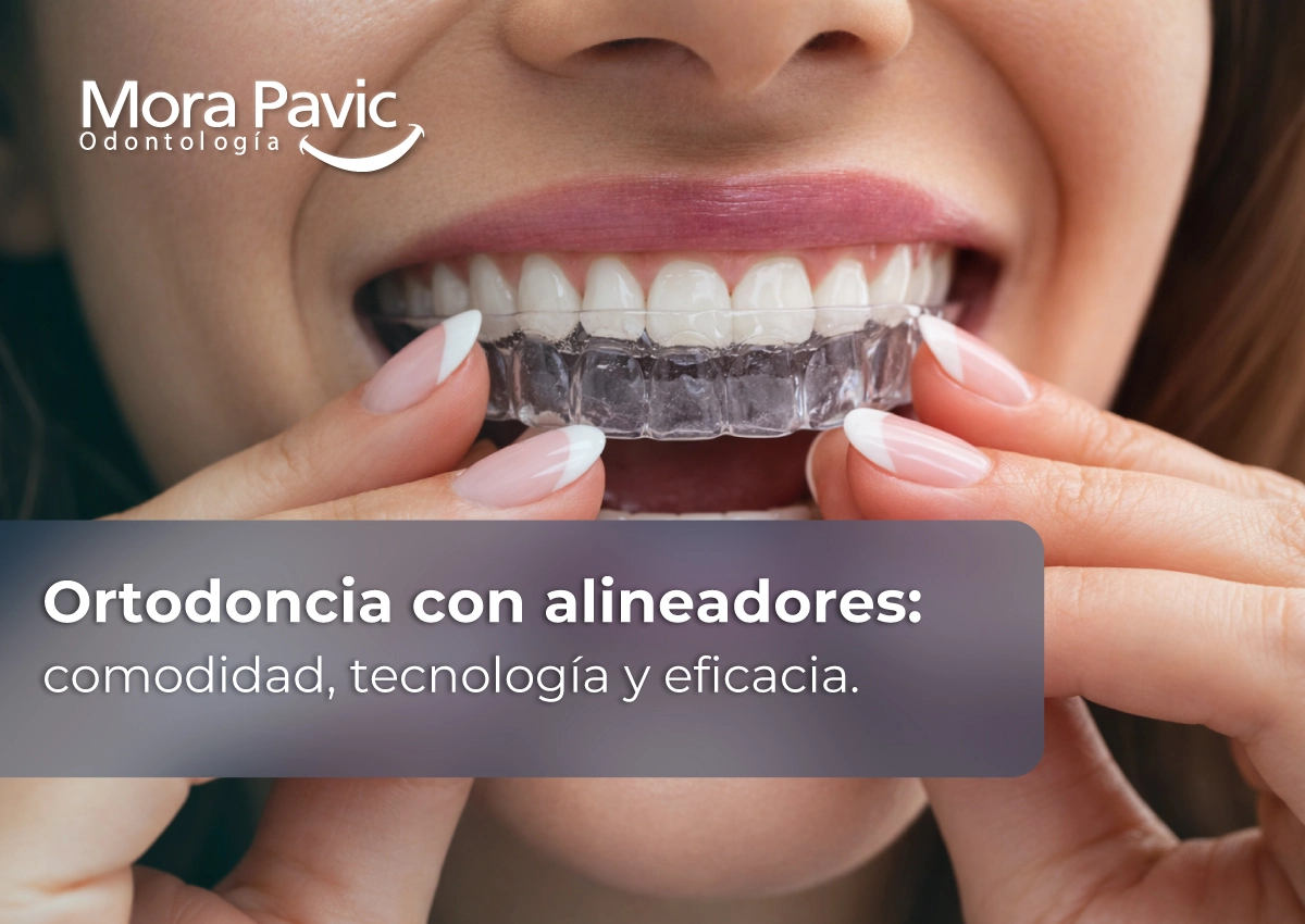 ortodoncia con alineadores tratamiento dental invisible